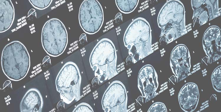 医療機器のイメージ写真